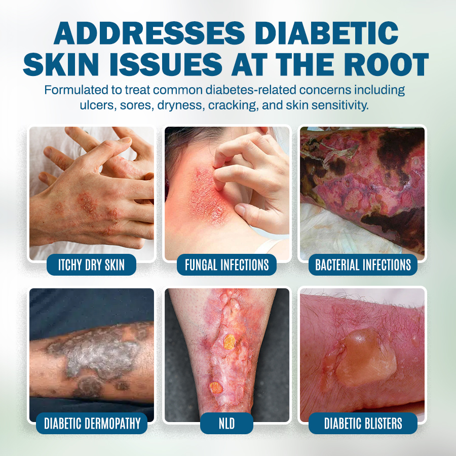 NEGUSY™ Skincare Designed for Diabetic Patients🌟
