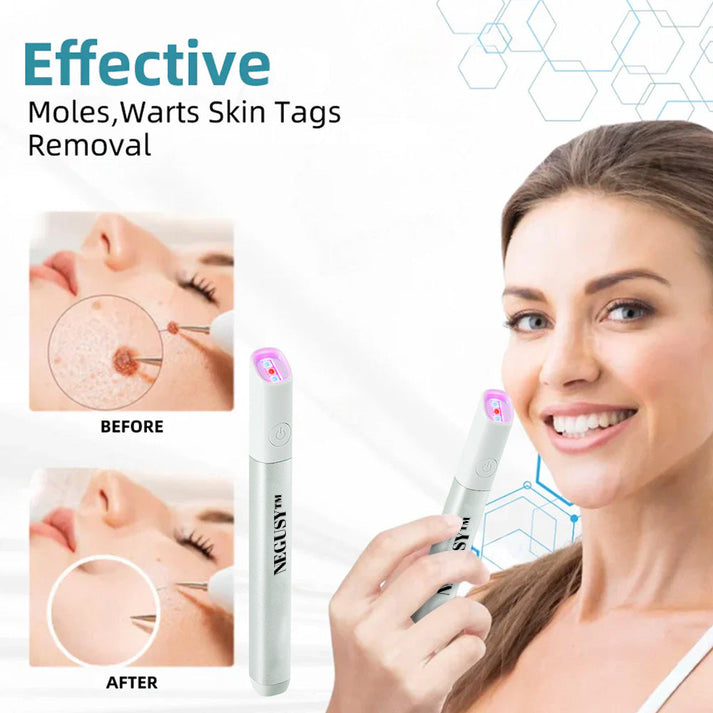 ✨NEGUSY™ All-in-One CO₂ Laser Eraser Pen | Removes Moles, Warts, Skin Flaws & Pigmentation