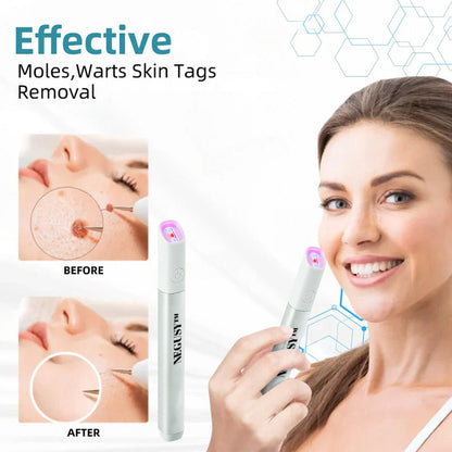 ✨NEGUSY™ All-in-One CO₂ Laser Eraser Pen | Removes Moles, Warts, Skin Flaws & Pigmentation