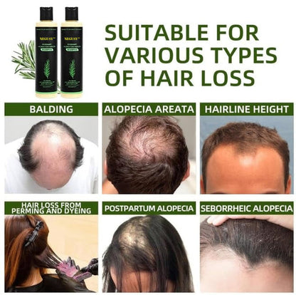 🔥LAST DAY 50% OFF - 🎅NEGUSY™ Organic Rosemary Hair Growth Shampoo