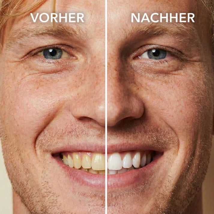 NEGUSY™ Tooth Polish