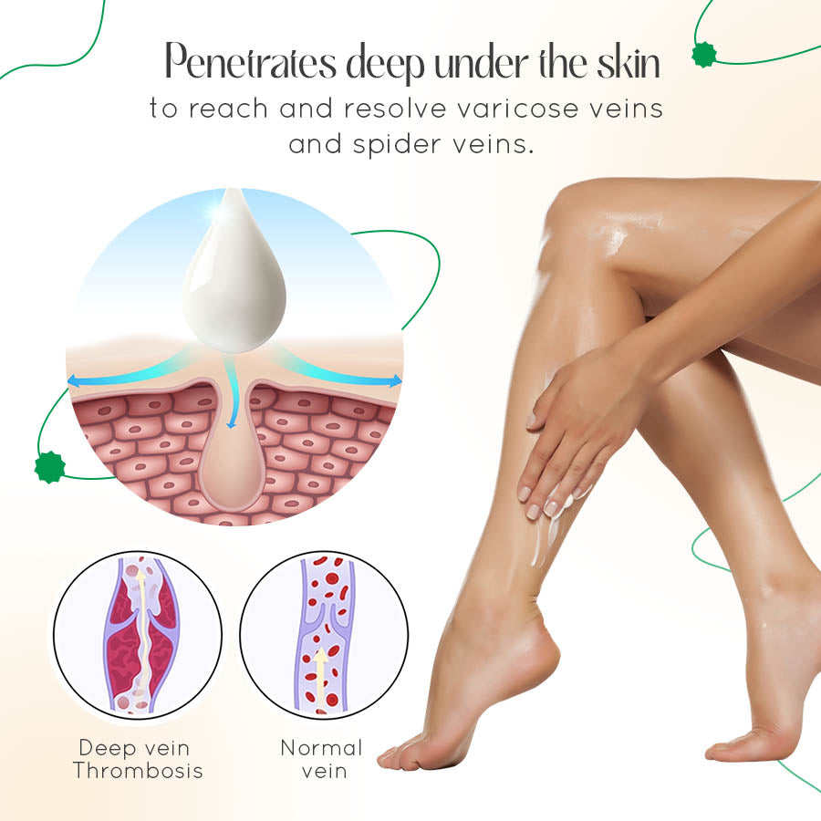 Seurico™ Varicose Vein Relief Cream🌿